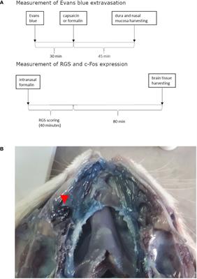 Association of Intranasal and Neurogenic Dural Inflammation in Experimental Acute Rhinosinusitis